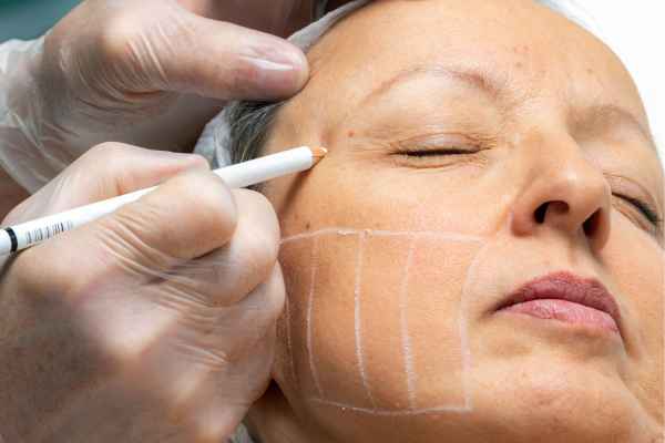 CryoPen: 5 Skin Concerns It May Be Used to Treat 4 What should you ask before having CryoPen treatment Lincolnshire?