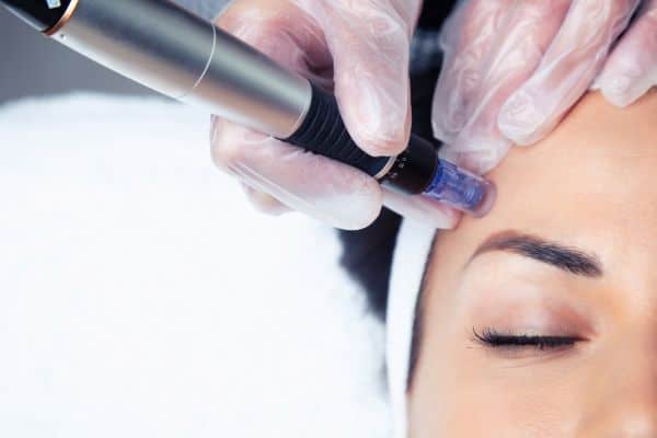 Explaining Total Skin Tightening Treatment and What to Expect 2 What Skin Concerns Can Total Skin Tightening Treatment Help With Lincolnshire?