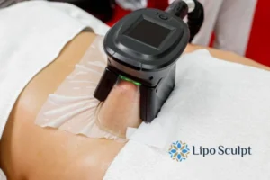 Does Fat Freezing At Home Work? 3 Fat freezing at home from Lipo Sculpt Lincolnshire